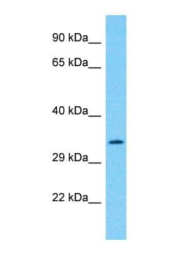 Polyclonal Rabbit anti-Human OXNAD1 Antibody (aa187-236, WB)
