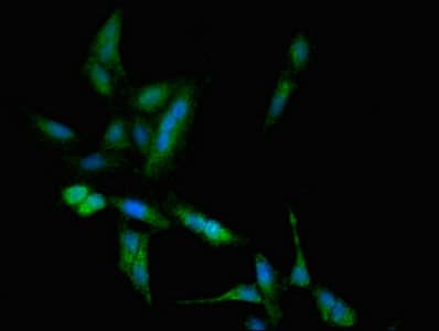 TBC1D4 / AS160 Antibody