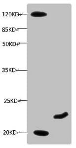 Monoclonal Mouse anti-Human MB / Myoglobin Antibody (clone 7A3D2, IHC, WB)