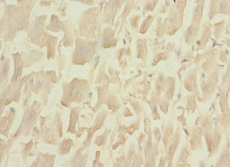 PLA2G4C Antibody
