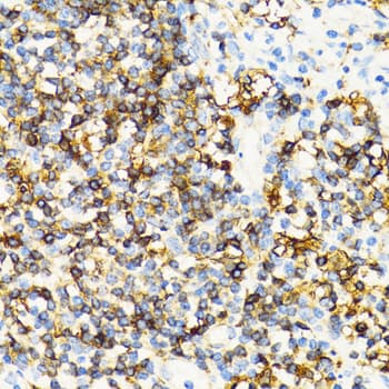 HLA-DRB3 Antibody