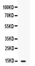 Polyclonal Rabbit anti-Human I-FABP / FABP2 Antibody (IHC, WB)