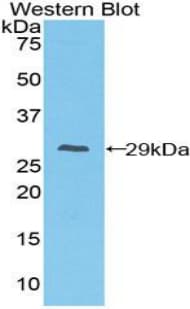 FCGR1A / CD64 Antibody (aa73-294)