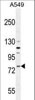 FZD6 / Frizzled 6 Antibody (aa493-520)