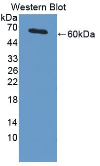 PIAS3 Antibody (aa11-280)