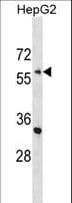 ENC1 Antibody (aa395-423)
