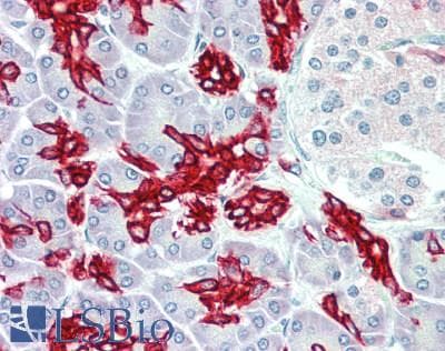 IHC-plus™ KRT19 / CK19 / Cytokeratin 19 Antibody