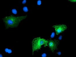 CCM2 / Malcavernin Antibody (clone OTI5C3, Carrier-free)