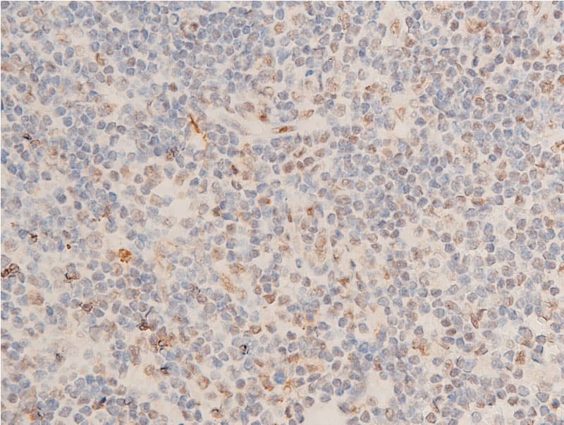 Polyclonal Rabbit anti-Human CHEK1 / CHK1 Antibody (phospho-Ser280, IHC, IF, WB)