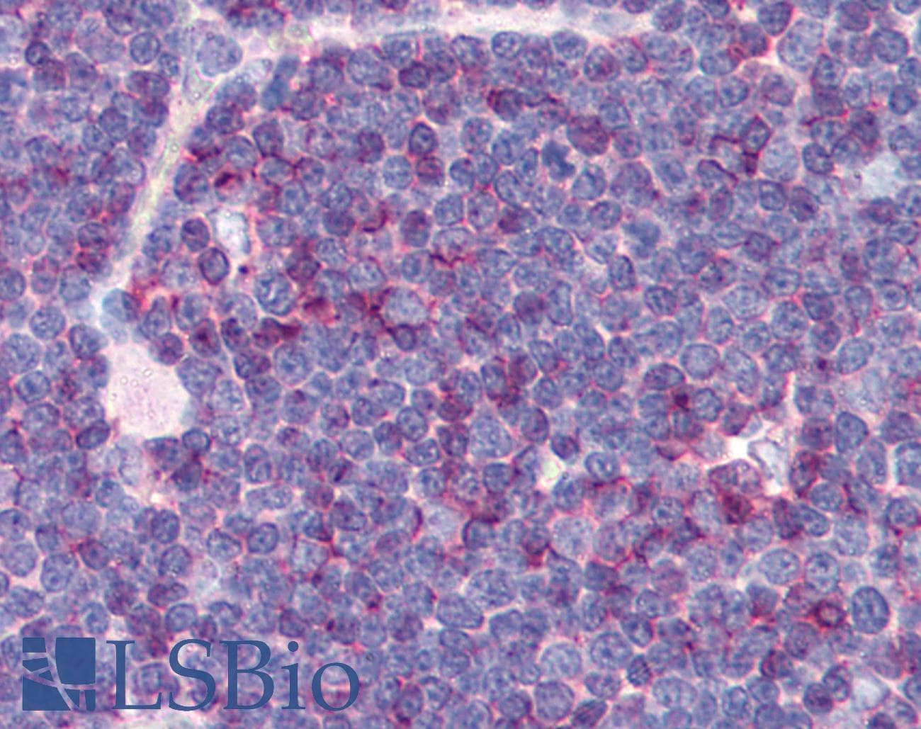 IHC-plus™ CD99 Antibody (clone MEM-131)