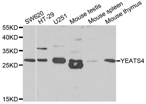 IHC-plus™ Polyclonal Rabbit anti-Human GAS41 Antibody (IHC, WB)