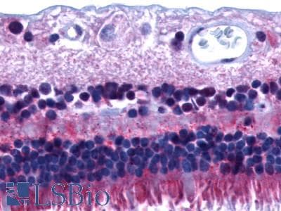 PathPlus™ Prostaglandin D2 Receptor Antibody (Extracellular Domain)