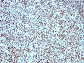 NCL / Nucleolin Antibody (clone 364-5, Ready-to-Use)