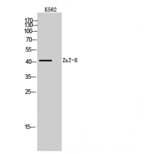 Polyclonal Rabbit anti-Human SLC30A8 / ZNT8 Antibody (140-220 aa, Internal, WB)