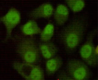 PRKDC / DNA-PKcs Antibody