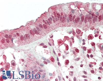 IHC-plus™ Polyclonal Rabbit anti-Human PD2 / PAF1 Antibody (aa475-525, IHC)