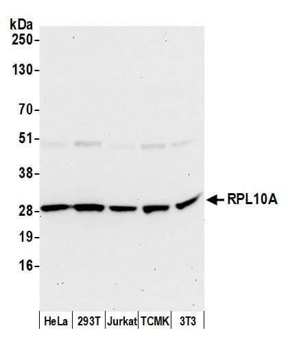 RPL10A Antibody (aa167-217)