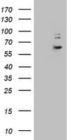 Monoclonal Mouse anti-Human KRT24 / Keratin 24 Antibody (clone OTI3A2, aa139-397, WB)