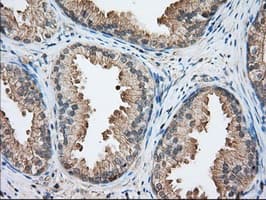 BHMT Antibody (clone OTI2F6)