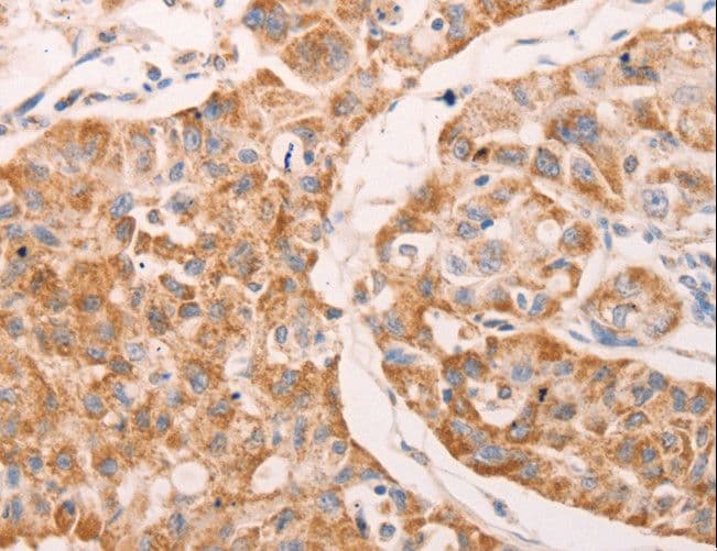 GNA11 Antibody