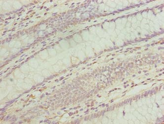 Polyclonal Rabbit anti-Human TMEM243 Antibody (IHC)