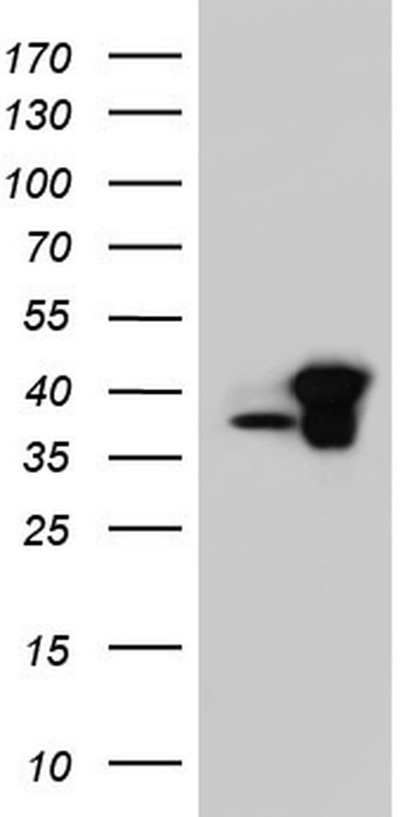 C14orf166 Antibody (clone OTI1B2)