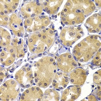 TERE1 / UBIAD1 Antibody