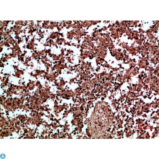 Polyclonal Rabbit anti-Human ANXA1 / Annexin A1 Antibody (IHC, WB)