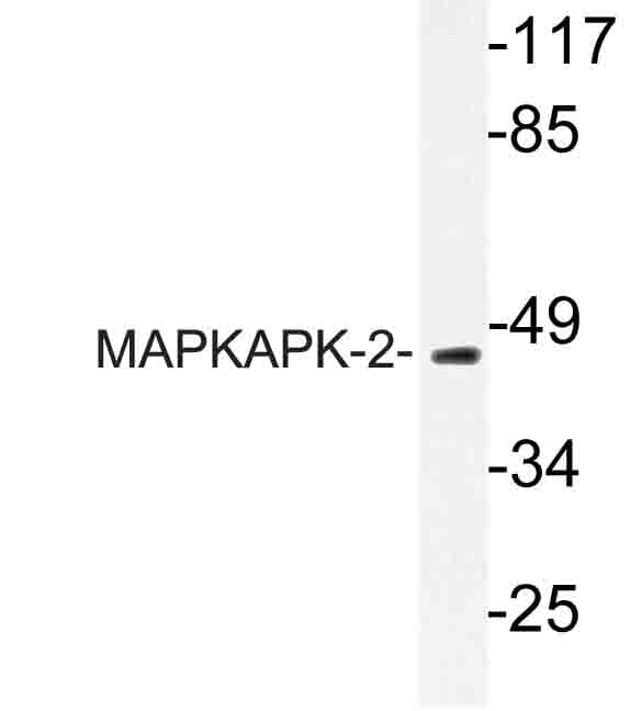 Polyclonal Rabbit anti-Human MAPKAPK2 / MAPKAP Kinase 2 Antibody (Asn218, IHC, WB)