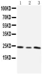 TIMP4 Antibody (aa209-224)