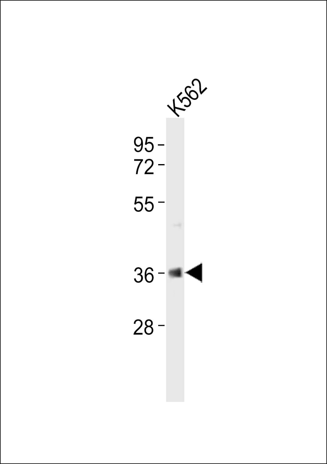 HnRNP-E1 / PCBP1 Antibody