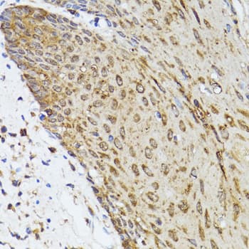 TOLLIP Antibody
