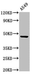 CCKAR / CCK1R Antibody