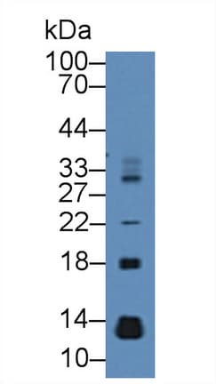 CCL28 / MEC Antibody (aa29-131)