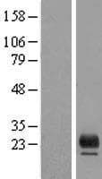 TMEM98 Protein (Over-Expression Lysate Myc-DDK (Flag))