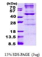 Human C1GALT1 Protein (Recombinant His)