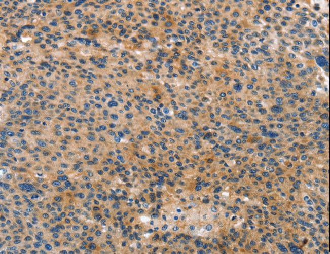 Polyclonal Rabbit anti-Human ANXA10 / Annexin A10 Antibody (IHC)