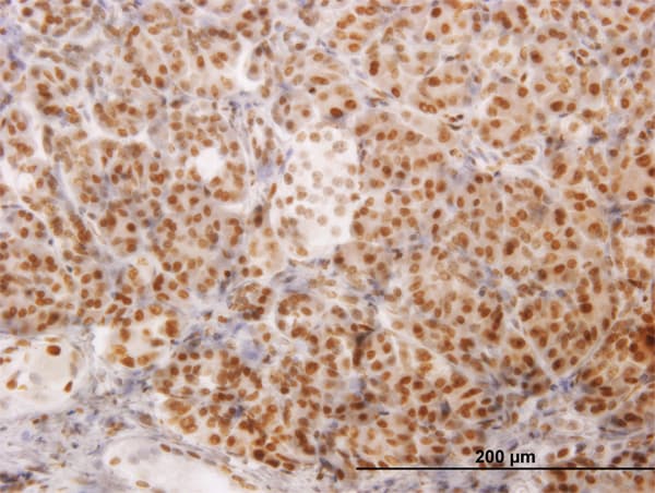 ARA70 / NCOA4 Antibody (clone 1E5)