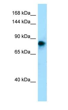 ADAM2 / Fertilin Beta Antibody (N-Terminus)
