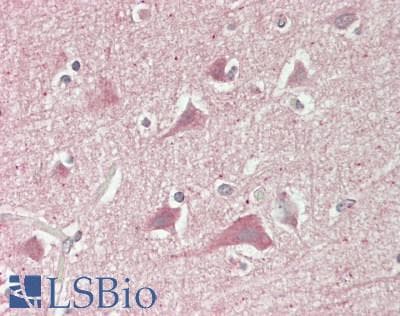 IHC-plus™ SLC6A15 / SBAT1 Antibody (N-Terminus)