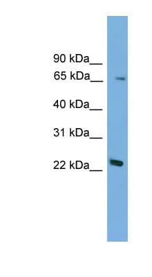 FOXN2 Antibody (N-Terminus)