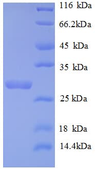 Human TP1 / TEP1 Protein (Recombinant His)