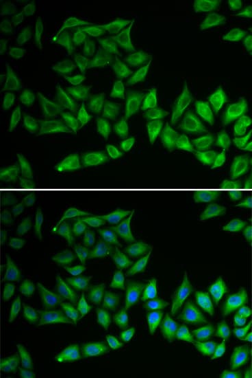 TPMT Antibody