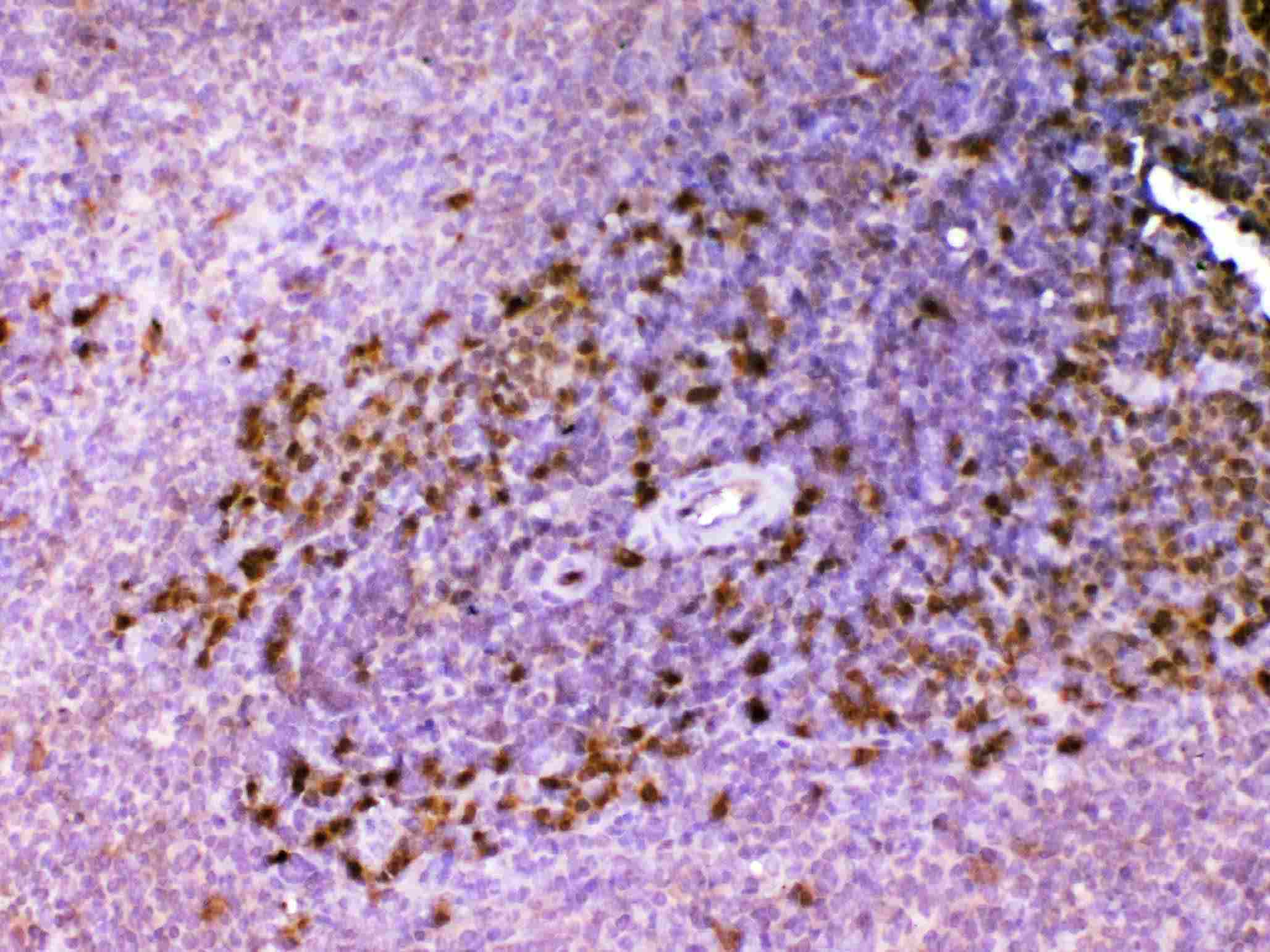 Polyclonal Rabbit anti-Rat ADA / Adenosine Deaminase Antibody (IHC, WB)