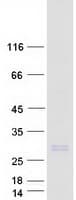 Human NRM Protein (Recombinant Myc-DDK (Flag))