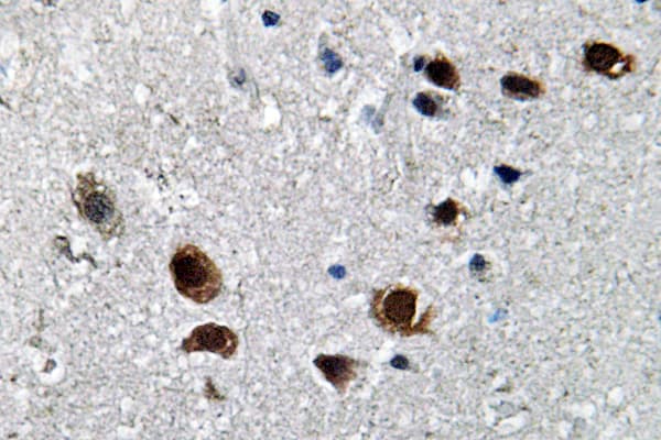 Polyclonal Rabbit anti-Human SCN2A / Nav1.2 Antibody (Lys1032, IHC)