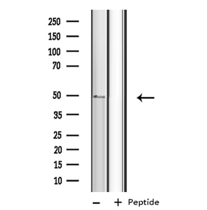 Polyclonal Rabbit anti-Human CYP4B1 Antibody (IHC, IF, WB)