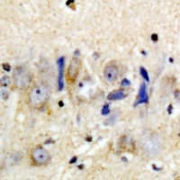 Polyclonal Rabbit anti-Human TREM1 Antibody (IHC, WB)