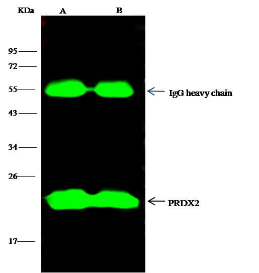 PRDX2 / Peroxiredoxin 2 Antibody (Preservative Free)