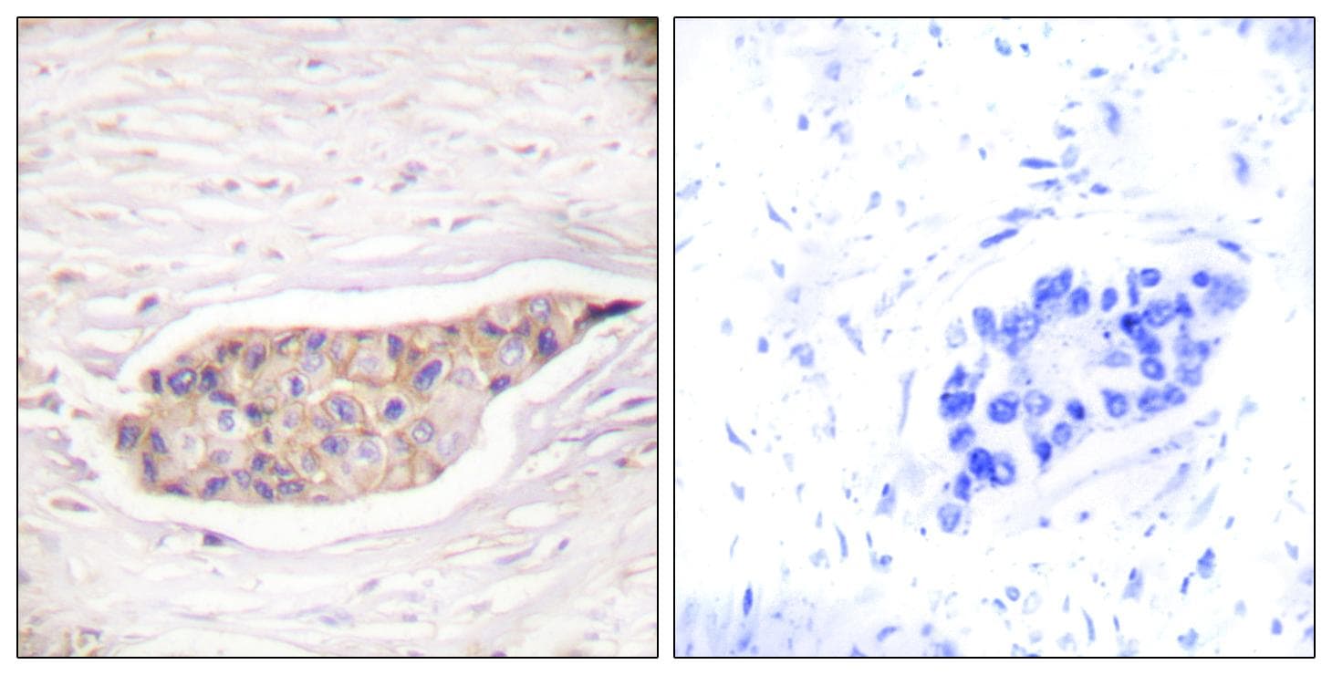 ANXA6/Annexin A6/Annexin VI Antibody